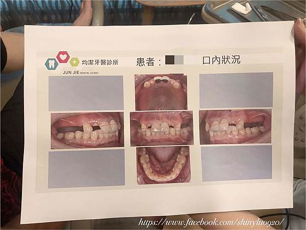 新北市中和區-均潔牙醫診所_35.jpg