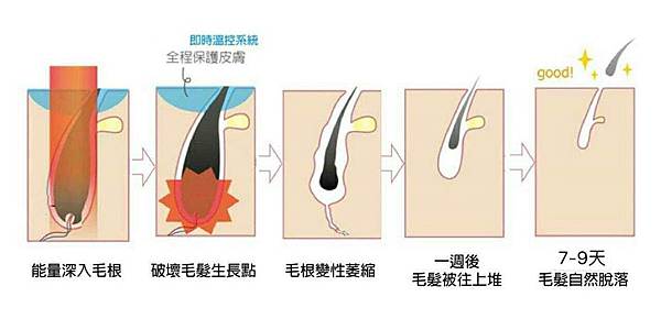 冰肌除毛Miss Q Beauty_21.jpg