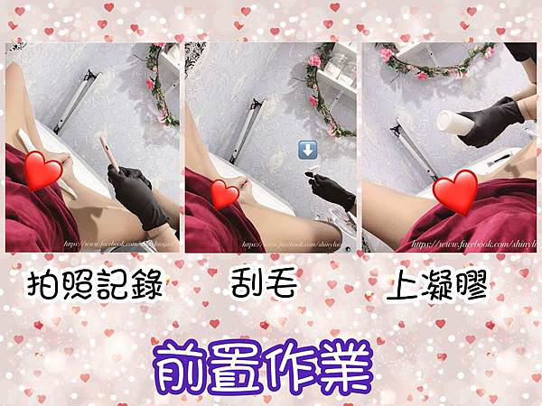 冰肌除毛Miss Q Beauty_30.jpg