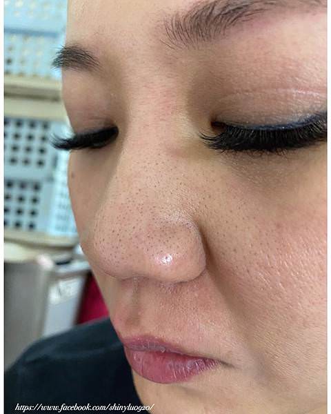 煥顏泡泡美膚儀+角質粉刺水11.jpg