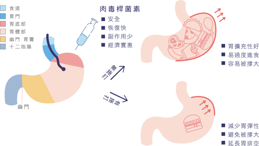 胃內肉毒