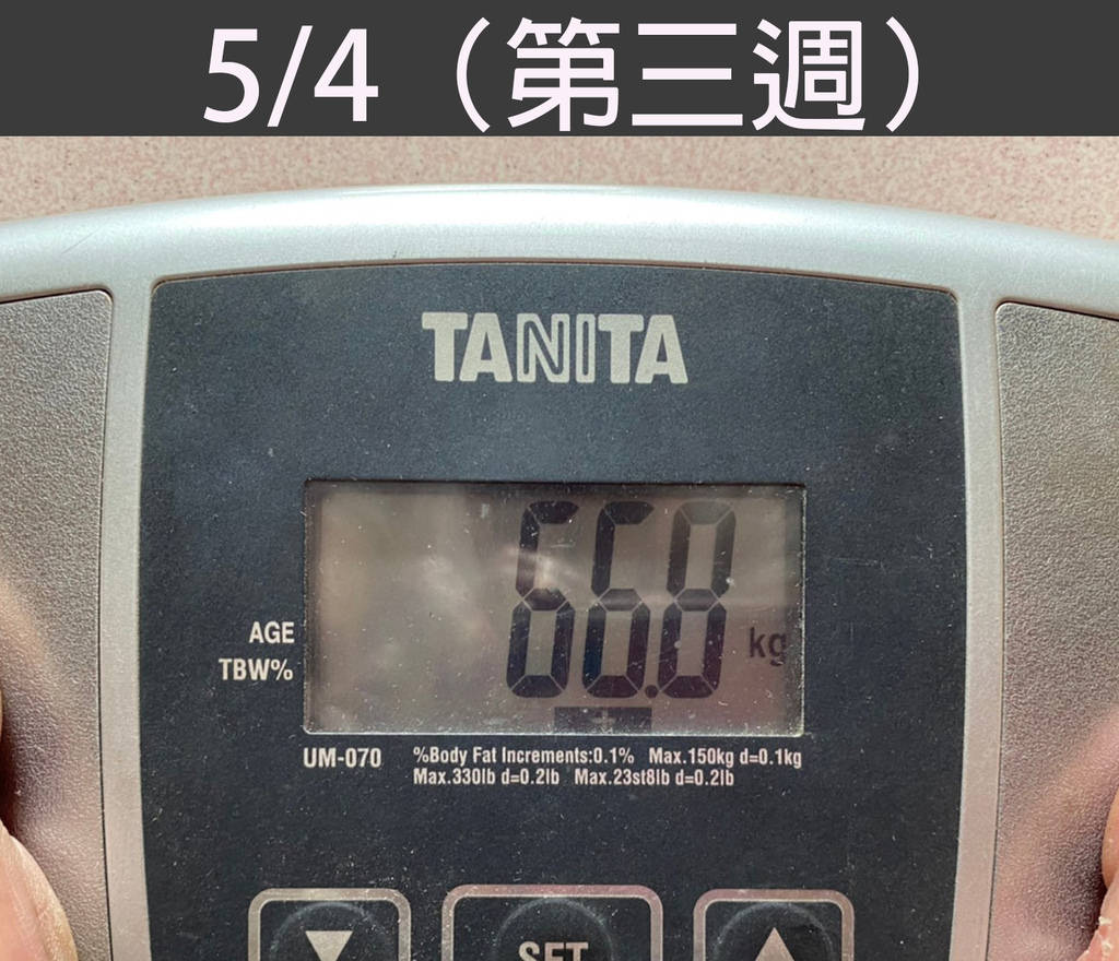 胃內肉毒體重記錄504.jpg