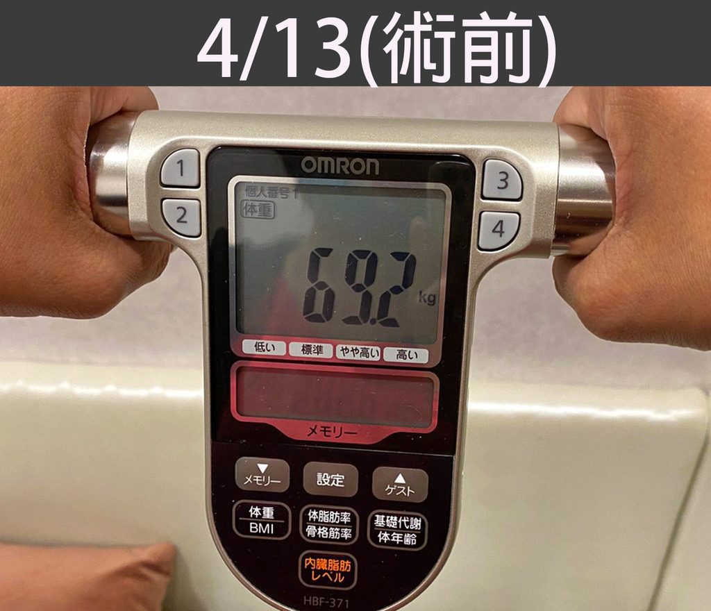 胃內肉毒體重記錄0413.jpg