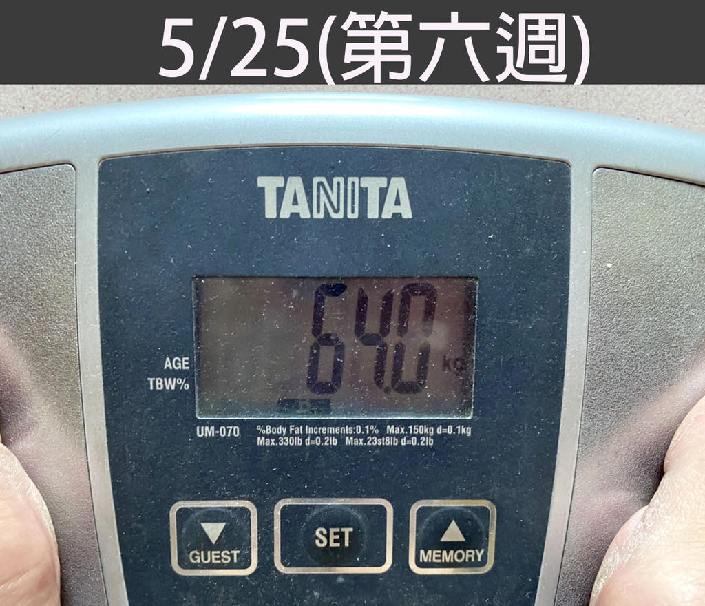 胃內肉毒體重記錄5025.jpg